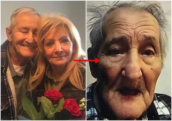 올해 89세인 남성 존 로스(John Ross)는 지난 밸런타인데이에 사랑하는 아내에게 장미꽃을 선물하기도 했다. 하지만 일 년 후 그의 모습은 전혀 달랐다. 얼굴에는 미소를 찾아볼 수 없었다.
