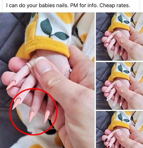 “쓰레기 짓” 아기에게 뾰족한 ‘가짜 손톱’ 붙여 논란