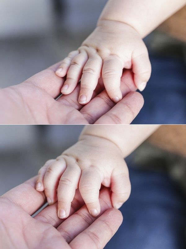 신생아의 손톱은 성인의 손톱과는 다르게 딱딱하지 않고 아주 얇고 말랑말랑한 편이다. 이에 쉽게 찢어질 수 있으며, 얇고 날카롭기 때문에 몸에 상처를 낼 가능성이 높다. / 출처 게티이미지뱅크